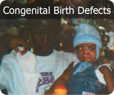 Birth Defects